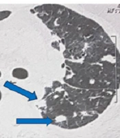 Jundishapur J Microbiol